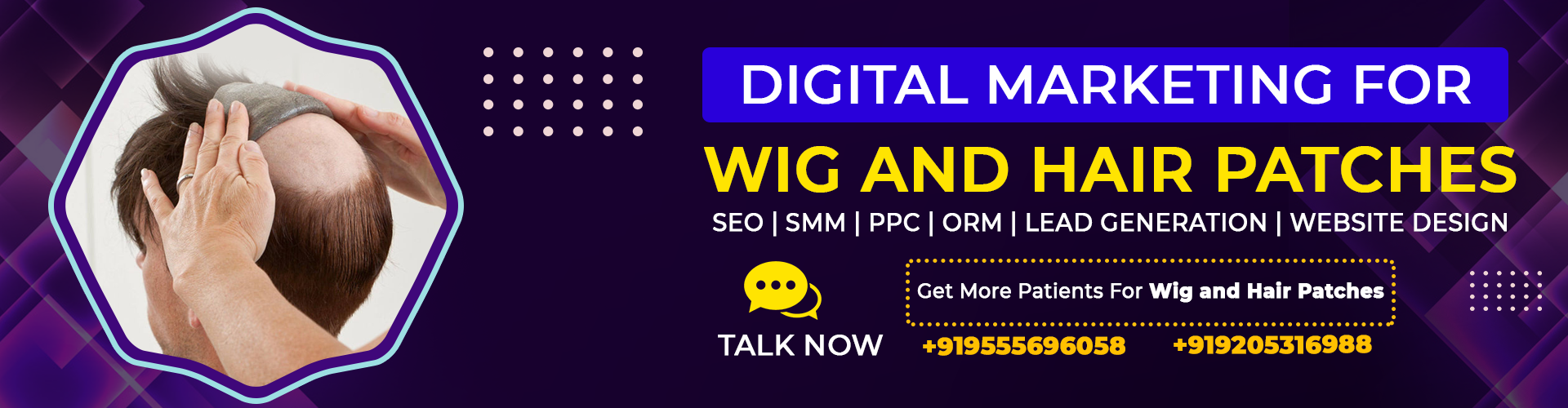digital-marketing-for-wig-and-hair-patches